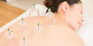 dry cupping, Chichester Dry Cupping Therapy, Chichester Chiropractic Centre
