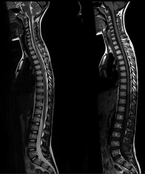 imaging, chichester xray, xray, mri, referral, chichester chiropractic, chichester chiropractor, chichester chiropractors, chichester, chiropractic, chiropractors, west sussex, health, neck pain, back pain, sciatica